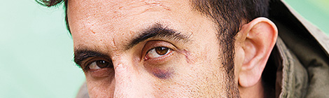 Scab duty call for young&nbsp;crims