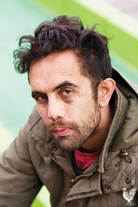 • Mike O’Hanlon sporting a black eye from a recent run in with a teenager. Photo by Matthew Dwyer