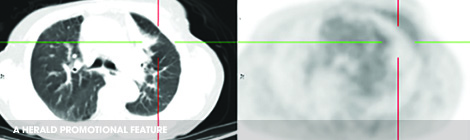 Innovative cancer care